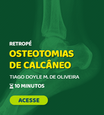 Percutânea 2023 - #12 - Osteotomias de Calcâneo