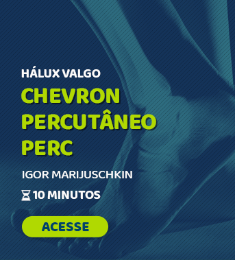 Percutânea 2023 - #04 - Chevron Percutâneo Perc (Hálux Valgo Leve/Moderado)